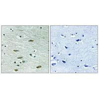 Immunohistochemistry analysis of paraffin-embedded human brain tissue using IGF1R (Ab-1346) antibody. Immunohistochemistry analysis of paraffin-embedded human brain tissue using IGF1R (Ab-1346) antibody.