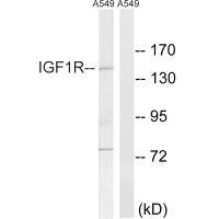 Western blot analysis of extracts from A549 cells, using IGF1R (Ab-1346) antibody.