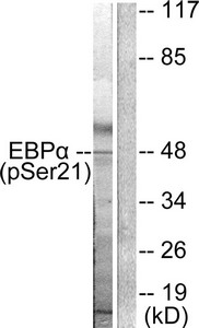 Western blot analysis of extracts from HepG2 cells treated with EGF using C/EBP-alpha (phospho-Ser21) Antibody.The lane on the right is treated with the antigen-specific peptide. Western blot analysis of extracts from HepG2 cells treated with EGF using C/EBP-alpha (phospho-Ser21) Antibody.The lane on the right is treated with the antigen-specific peptide.