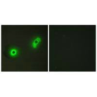 Immunofluorescence analysis of A549 cells, using Ik3-2 antibody.