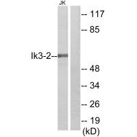 Western blot analysis of extracts from Jurkat cells, using Ik3-2 antibody. Western blot analysis of extracts from Jurkat cells, using Ik3-2 antibody.