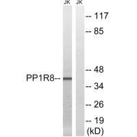 Western blot analysis of extracts from Jurkat cells, using PPP1R8 antibody. Western blot analysis of extracts from Jurkat cells, using PPP1R8 antibody.