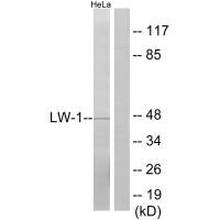 Western blot analysis of extracts from HeLa cells, using LW-1 antibody. Western blot analysis of extracts from HeLa cells, using LW-1 antibody.