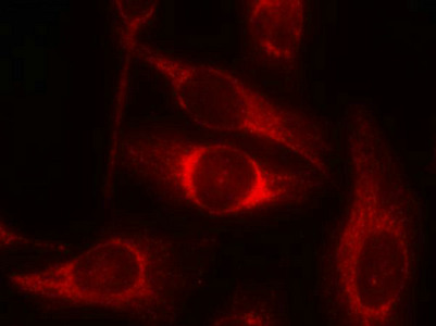 Immunofluorescence staining of methanol-fixed Hela cells using p53(Phospho-Ser46) Antibody.