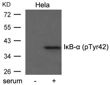 Western blot analysis of extract from Hela cells untreated or treated with serum using IkB-a(Phospho-Tyr42) antibody. Western blot analysis of extract from Hela cells untreated or treated with serum using IkB-a(Phospho-Tyr42) antibody.
