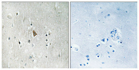 Immunohistochemical analysis of paraffin-embedded human brain tissue using IGF1R (Phospho-Tyr1346) antibody (left)or the same antibody preincubated with blocking peptide (right). Immunohistochemical analysis of paraffin-embedded human brain tissue using IGF1R (Phospho-Tyr1346) antibody (left)or the same antibody preincubated with blocking peptide (right).