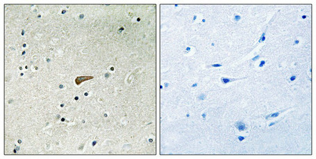 Immunohistochemical analysis of paraffin-embedded human brain tissue using FRS2 (Phospho-Tyr436) antibody (left)or the same antibody preincubated with blocking peptide (right).