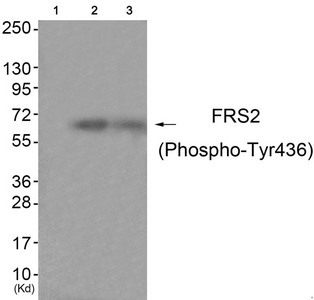 Western blot analysis of extracts from HuvEc cells (Lane 2) and JK cells (Lane 3), using FRS2 (Phospho-Tyr436) Antibody. The lane on the left is treated with antigen-specific peptide.