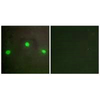 Immunofluorescence analysis of A549 cells, using ATRX antibody. Immunofluorescence analysis of A549 cells, using ATRX antibody.