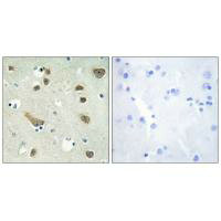 Immunohistochemistry analysis of paraffin-embedded human brain tissue using 14-3-3 gamma antibody.