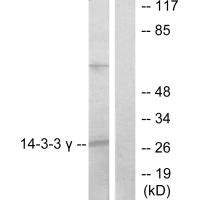 Western blot analysis of extracts from K562 cells, treated with insulin (0.01U/ml, 15mins), using 14-3-3 gamma antibody. Western blot analysis of extracts from K562 cells, treated with insulin (0.01U/ml, 15mins), using 14-3-3 gamma antibody.