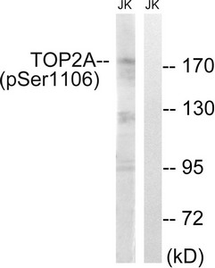 Western blot analysis of extracts from Jurkat cells, treated with paclitaxel (1uM, 24hours), using TOP2A (Phospho-Ser1106) antibody. The lane on the right is treated with the synthesized peptide. Western blot analysis of extracts from Jurkat cells, treated with paclitaxel (1uM, 24hours), using TOP2A (Phospho-Ser1106) antibody. The lane on the right is treated with the synthesized peptide.