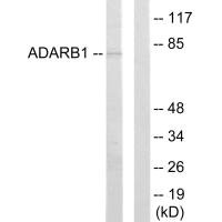 Western blot analysis of extracts from HepG2 cells, using ADARB1 antibody. Western blot analysis of extracts from HepG2 cells, using ADARB1 antibody.