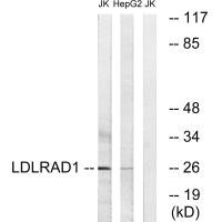 Western blot analysis of extracts from Jurkat cells and HepG2 cells, using LDLRAD1 antibody. Western blot analysis of extracts from Jurkat cells and HepG2 cells, using LDLRAD1 antibody.