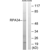 Western blot analysis of extracts from A549 cells, using CD3EAP antibody. Western blot analysis of extracts from A549 cells, using CD3EAP antibody.