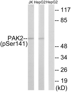 Western blot analysis of extracts from HepG2 cells treated with Adriamycin (0.5uM, 24hours) and Jurkat cells treated with PMA (125ng/ml, 30mins) using PAK2 (Phospho-Ser141) antibody. The lane on the right is treated with the synthesized peptide. Western blot analysis of extracts from HepG2 cells treated with Adriamycin (0.5uM, 24hours) and Jurkat cells treated with PMA (125ng/ml, 30mins) using PAK2 (Phospho-Ser141) antibody. The lane on the right is treated with the synthesized peptide.
