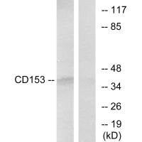 Western blot analysis of extracts from RAW264.7 cells, using CD153 antibody. Western blot analysis of extracts from RAW264.7 cells, using CD153 antibody.