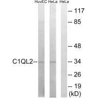 Western blot analysis of extracts from HUVEC cells and HeLa cells, using C1QL2 antibody. Western blot analysis of extracts from HUVEC cells and HeLa cells, using C1QL2 antibody.
