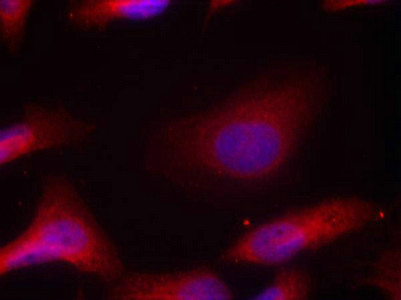 Immunofluorescence staining of methanol-fixed Hela cells using Src(Phospho-Tyr529) Antibody.