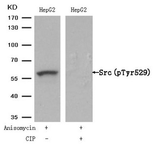 Western blot analysis of extracts from HepG2 cells, treated with Anisomycin or calf intestinal phosphatase (CIP), using Src (Phospho-Tyr529) Antibody.