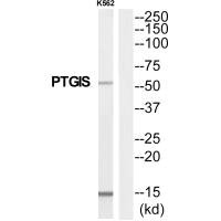 Western blot analysis of extracts from K562 cells, using PTGIS antibody. Western blot analysis of extracts from K562 cells, using PTGIS antibody.
