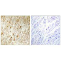 Immunohistochemistry analysis of paraffin-embedded human heart tissue using BCA3 antibody.