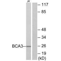 Western blot analysis of extracts from Jurkat cells, using BCA3 antibody. Western blot analysis of extracts from Jurkat cells, using BCA3 antibody.