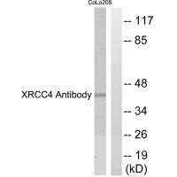 Western blot analysis of extracts from COLO205 cells, using XRCC4 antibody. Western blot analysis of extracts from COLO205 cells, using XRCC4 antibody.