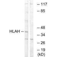 Western blot analysis of extracts from LOVO cells, using HLAH antibody.