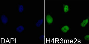 Immunofluorescence analysis of 293T cell using H4R3me2s antibody. Blue: DAPI for nuclear staining.