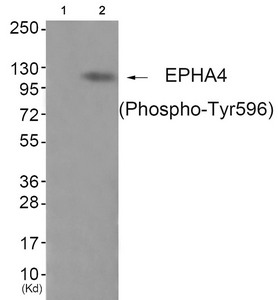 Western blot analysis of extracts from JK cells (Lane 2), using EPHA4 (Phospho-Tyr596) Antibody. The lane on the left is treated with antigen-specific peptide. Western blot analysis of extracts from JK cells (Lane 2), using EPHA4 (Phospho-Tyr596) Antibody. The lane on the left is treated with antigen-specific peptide.