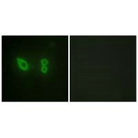 Immunofluorescence analysis of HeLa cells, using Actin alpha-2/3 antibody.