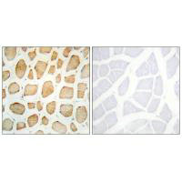 Immunohistochemistry analysis of paraffin-embedded human skeletal muscle tissue using Actin alpha-2/3 antibody.