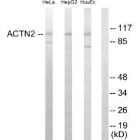 Western blot analysis of extracts from HeLa cells, HepG2 cells and HUVEC cells, using Actin alpha-2/3 antibody. Western blot analysis of extracts from HeLa cells, HepG2 cells and HUVEC cells, using Actin alpha-2/3 antibody.