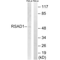 Western blot analysis of extracts from HeLa cells, using RSAD1 antibody. Western blot analysis of extracts from HeLa cells, using RSAD1 antibody.