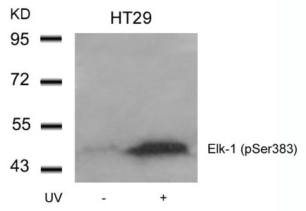 Western blot analysis of extracts from HT29 cells untreated or treated with UV using Elk-1(Phospho-Ser383) Antibody. Western blot analysis of extracts from HT29 cells untreated or treated with UV using Elk-1(Phospho-Ser383) Antibody.
