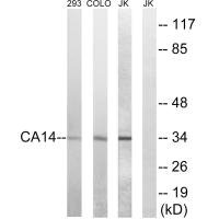 Western blot analysis of extracts from 293 cells, COLO cells,and Jurkat cells, using CA14 antibody. Western blot analysis of extracts from 293 cells, COLO cells,and Jurkat cells, using CA14 antibody.