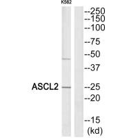 Western blot analysis of extracts from K562 cells, using ASCL2 antibody. Western blot analysis of extracts from K562 cells, using ASCL2 antibody.