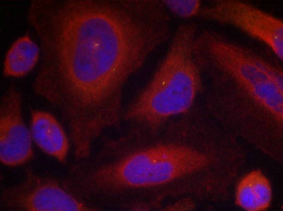 Immunofluorescence staining of methanol-fixed Hela cells using Synaptotagmin 1 (Phospho-Ser309) Antibody. Immunofluorescence staining of methanol-fixed Hela cells using Synaptotagmin 1 (Phospho-Ser309) Antibody.