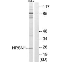 Western blot analysis of extracts from HeLa cells, using NRSN1 antibody. Western blot analysis of extracts from HeLa cells, using NRSN1 antibody.