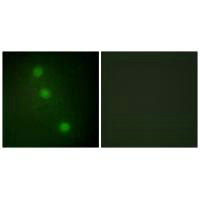 Immunofluorescence analysis of HUVEC cells, using ATF1 antibody.