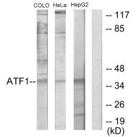 Western blot analysis of extracts from COLO205 cells, HeLa cells and HepG2 cells, using ATF1 antibody. Western blot analysis of extracts from COLO205 cells, HeLa cells and HepG2 cells, using ATF1 antibody.