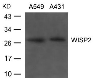 Western blot analysis of extracts from A549, A431 cells using WISP2 Antibody. Western blot analysis of extracts from A549, A431 cells using WISP2 Antibody.