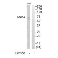 Western blot analysis of extracts from HepG2 cells, using ABCD4 antibody. Western blot analysis of extracts from HepG2 cells, using ABCD4 antibody.