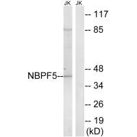 Western blot analysis of extracts from Jurkat cells, using NBPF5 antibody. Western blot analysis of extracts from Jurkat cells, using NBPF5 antibody.