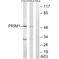 Western blot analysis of extracts from HepG2 cells, using PRIM1 antibody. Western blot analysis of extracts from HepG2 cells, using PRIM1 antibody.