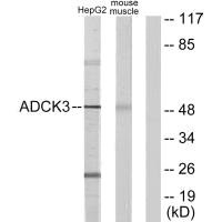 Western blot analysis of extracts from HepG2 cells and mouse muscle cells, using ADCK3 antibody. Western blot analysis of extracts from HepG2 cells and mouse muscle cells, using ADCK3 antibody.