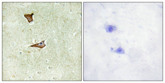 Immunohistochemical analysis of paraffin-embedded human brain tissue using IGF2R (Phospho-Ser2409) antibody (left)or the same antibody preincubated with blocking peptide (right).