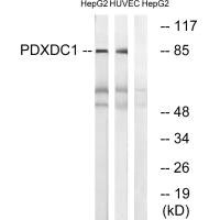Western blot analysis of extracts from HepG2 cells and HUVEC cells, using PDXDC1 antibody. Western blot analysis of extracts from HepG2 cells and HUVEC cells, using PDXDC1 antibody.
