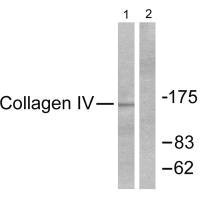 Western blot analysis of extracts from HeLa cells, using Collagen IV antibody. Western blot analysis of extracts from HeLa cells, using Collagen IV antibody.